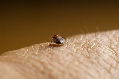 Чем опасны клопы и их укусы: потенциальные проблемы со здоровьем из-за  насекомых-вампиров