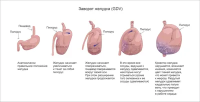 Гингивит и пародонтит - Cтоматология Май