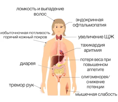 Свищ толстой кишки — surgery-first.ru