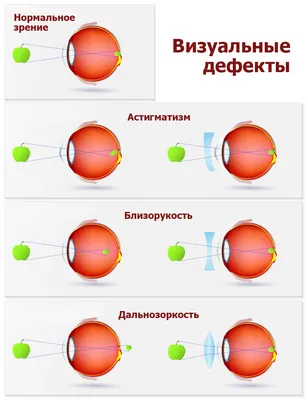 Острота зрения и ее определение с помощью специальных таблиц