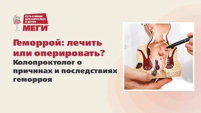 Лечение геморроя, операция в Москве - Клиника проктологии Эксперт