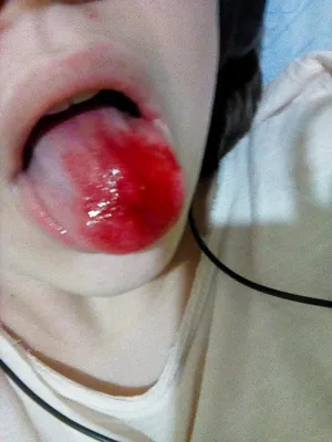 Искусать губы до крови : @rgsbf5 Yana Kogut wish
