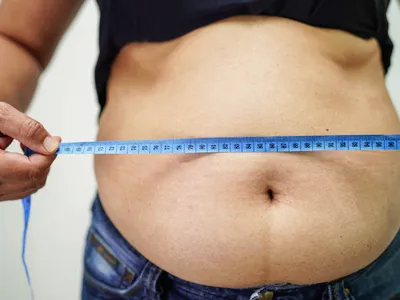 Избыточный вес и ожирение. В чем разница? - доктор Мужиков С.П.