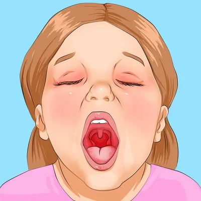 Красное ли это горло? — 9 ответов | форум Babyblog