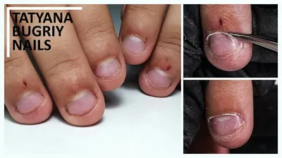 Наращивание на ОБГРЫЗЕННЫЕ ногти | Как исправить?