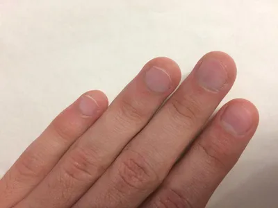 Наращивание на обгрызенные ногти - YouTube