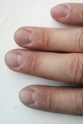 Маникюр на сгрызенные ногти (53 фото)