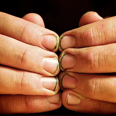 Ответы Mail.ru: Как восстановить обгрызенные ногти?