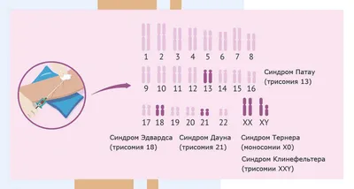 Синдром Эдвардса 🔻вырожденное состояние возникает, когда у человека есть  дополнительная копия хромосомы 18 — трисомия 18. 🔻Это состояние я… |  Instagram