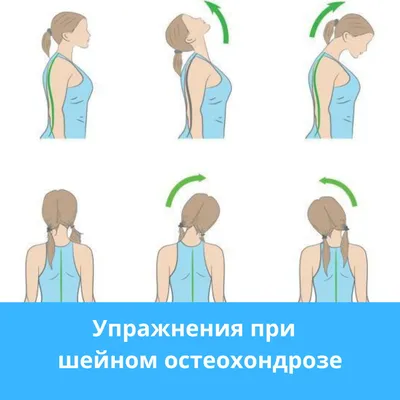 Упражнения при шейном остеохондрозе в картинках обои