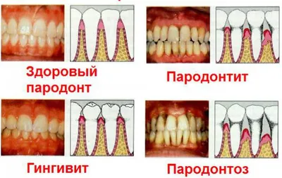 Заболевания полости рта в картинках обои